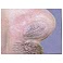 first defense nasal screens first defense nasal screens